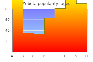 purchase zebeta 10 mg