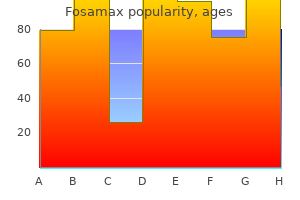 fosamax 35 mg buy discount on line