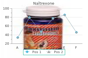 50 mg naltrexone order fast delivery