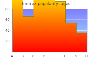 buy 25 mg imitrex with mastercard