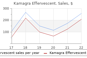 kamagra effervescent 100 mg free shipping