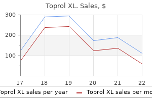 buy cheap toprol xl 25 mg on-line