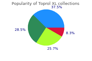 toprol xl 50 mg generic on line