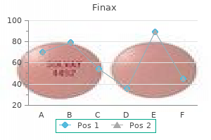 cheap finax 1 mg mastercard